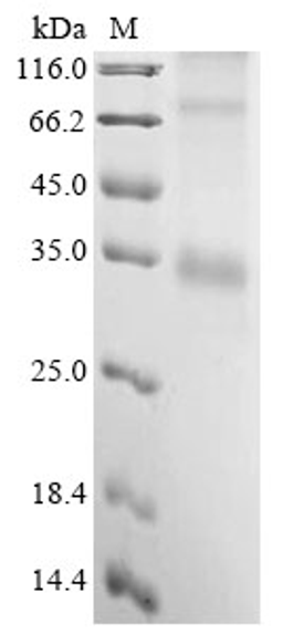 (Tris-Glycine gel) Discontinuous SDS-PAGE (reduced) with 5% enrichment gel and 15% separation gel.