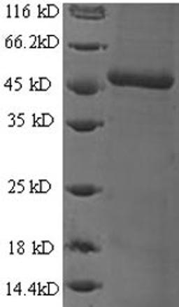 (Tris-Glycine gel) Discontinuous SDS-PAGE (reduced) with 5% enrichment gel and 15% separation gel.