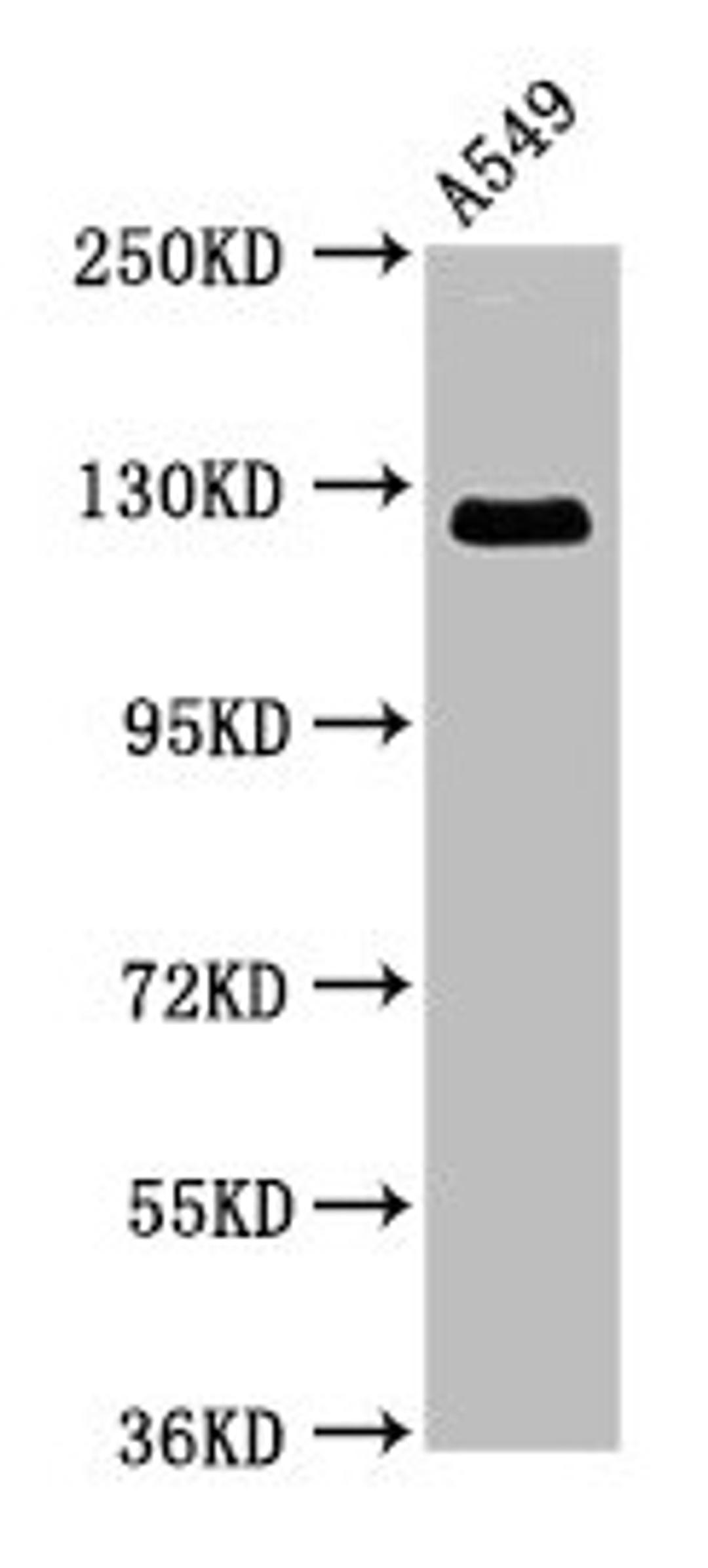 Western Blot. Positive WB detected in: A549 whole cell lysate. All lanes: RANBP17 antibody at 3.9µg/ml. Secondary. Goat polyclonal to rabbit IgG at 1/50000 dilution. Predicted band size: 125, 66 kDa. Observed band size: 125 kDa
