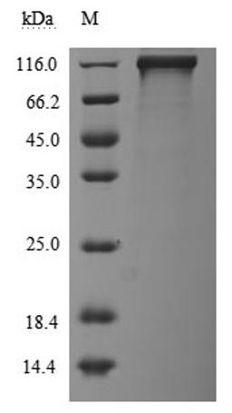 (Tris-Glycine gel) Discontinuous SDS-PAGE (reduced) with 5% enrichment gel and 15% separation gel.