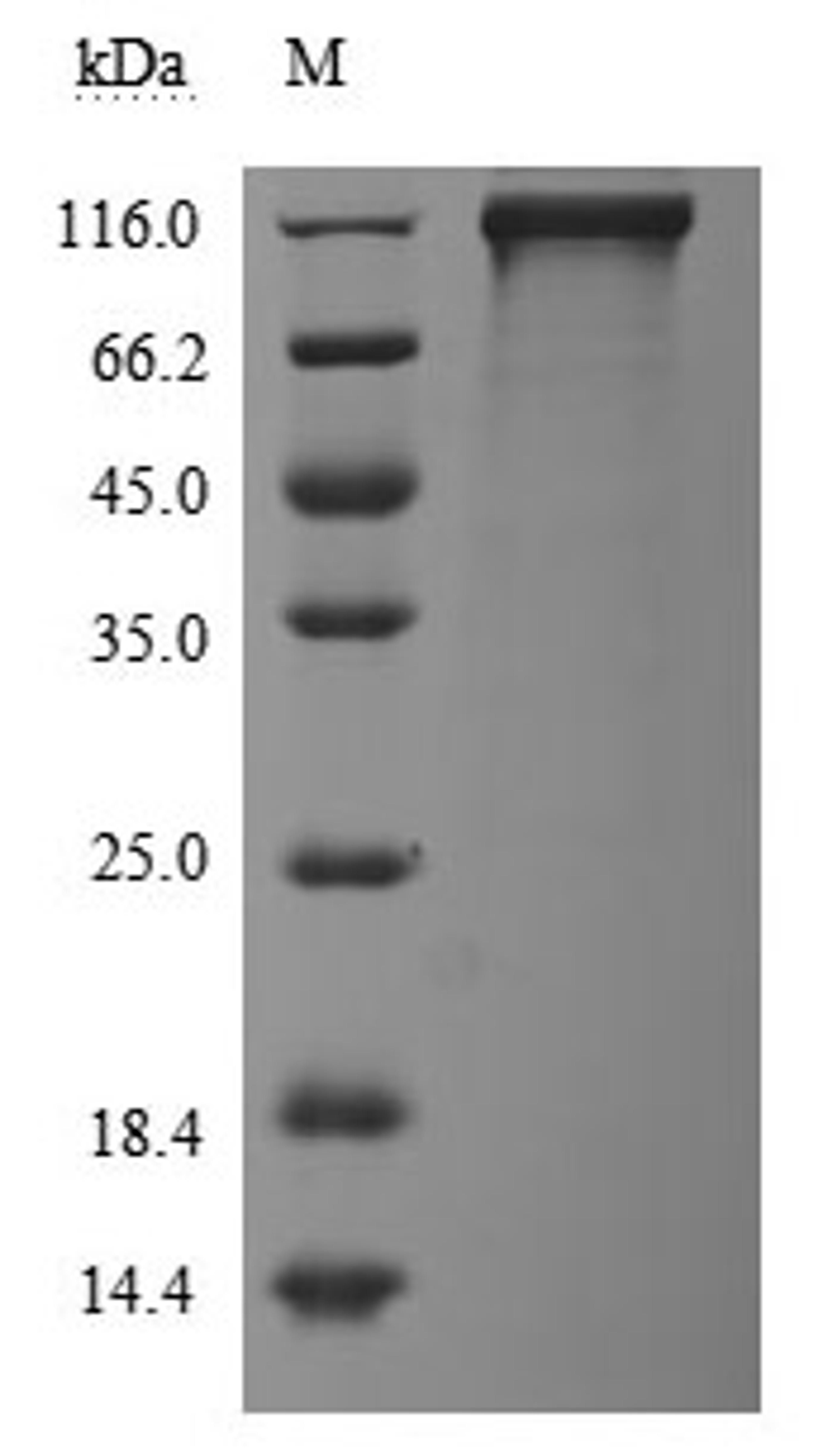 (Tris-Glycine gel) Discontinuous SDS-PAGE (reduced) with 5% enrichment gel and 15% separation gel.