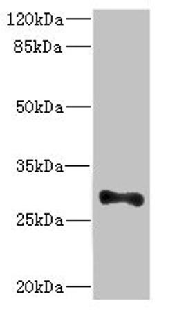 Western blot. All lanes: ICAM4 antibody at 4.98ug/ml + Mouse brain tissue. Secondary. Goat polyclonal to rabbit IgG at 1/10000 dilution. Predicted band size: 30, 26 kDa. Observed band size: 30 kDa. 