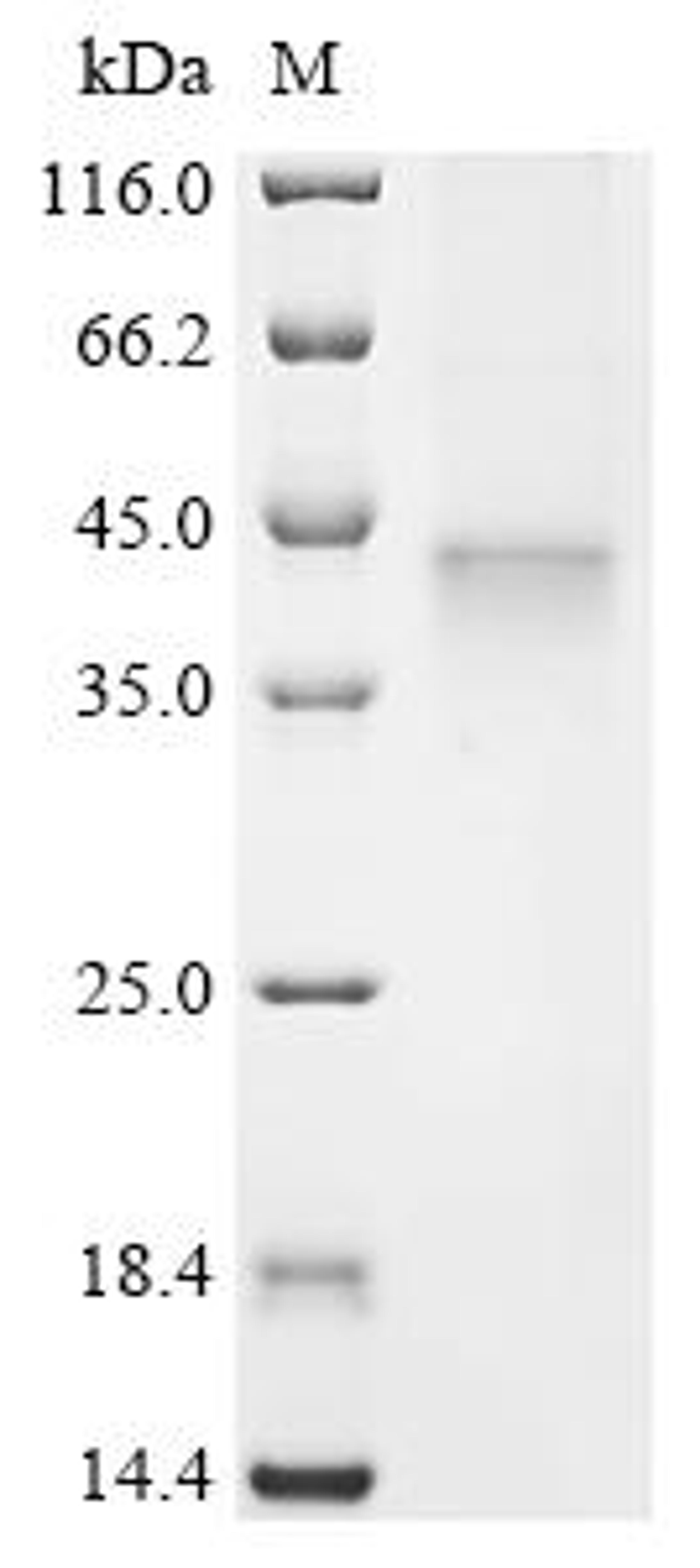 (Tris-Glycine gel) Discontinuous SDS-PAGE (reduced) with 5% enrichment gel and 15% separation gel.