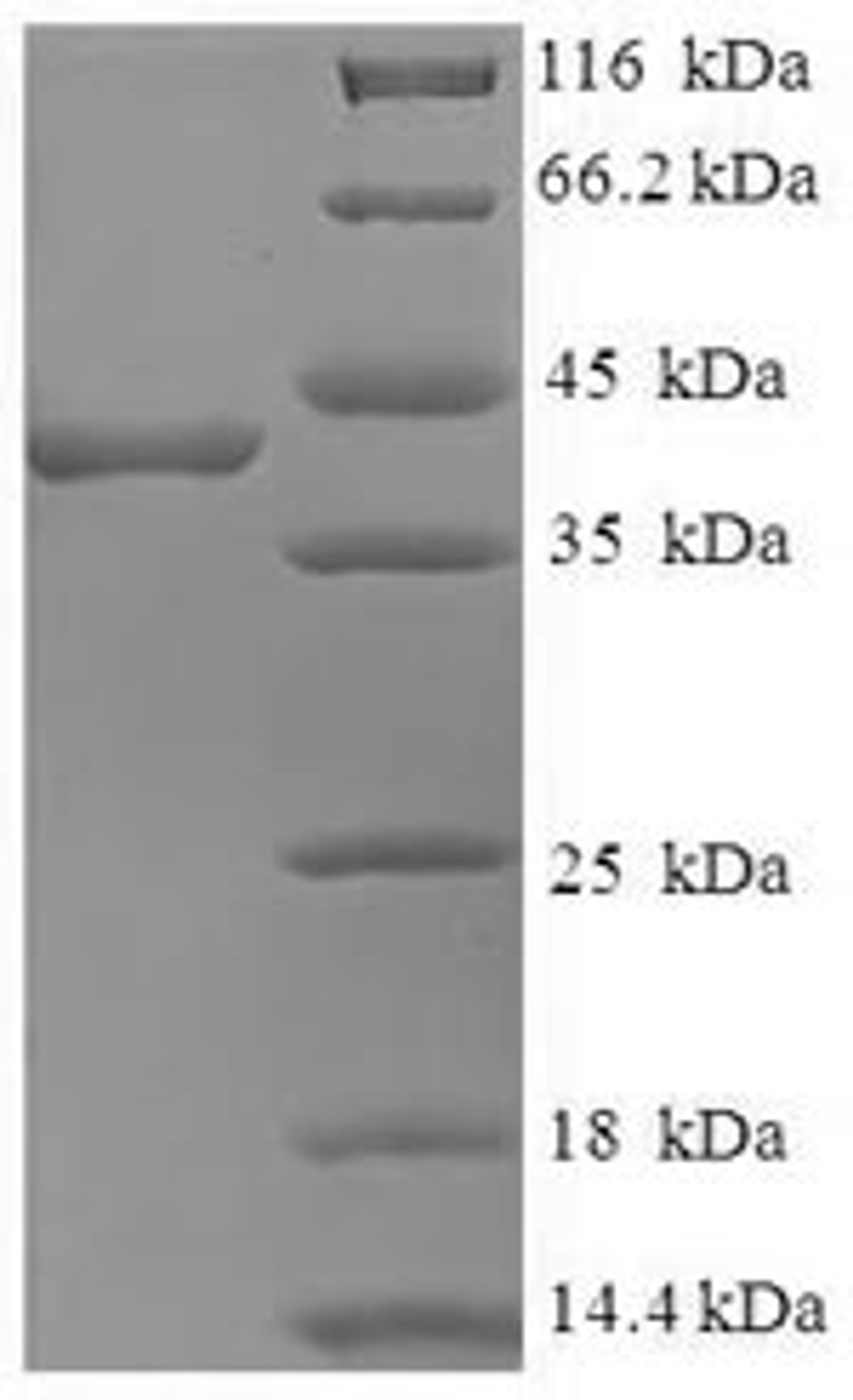 (Tris-Glycine gel) Discontinuous SDS-PAGE (reduced) with 5% enrichment gel and 15% separation gel.
