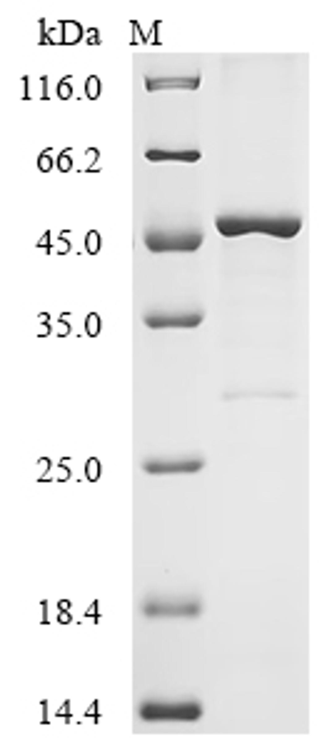 (Tris-Glycine gel) Discontinuous SDS-PAGE (reduced) with 5% enrichment gel and 15% separation gel.