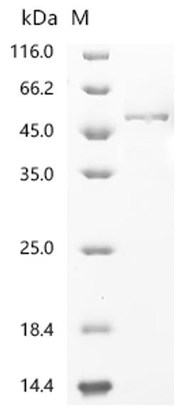 (Tris-Glycine gel) Discontinuous SDS-PAGE (reduced) with 5% enrichment gel and 15% separation gel.