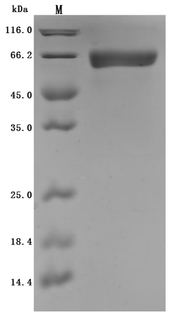 (Tris-Glycine gel) Discontinuous SDS-PAGE (reduced) with 5% enrichment gel and 15% separation gel.