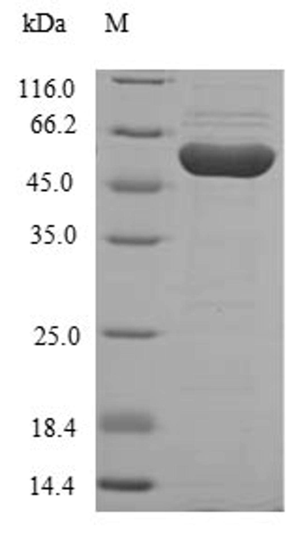 (Tris-Glycine gel) Discontinuous SDS-PAGE (reduced) with 5% enrichment gel and 15% separation gel.