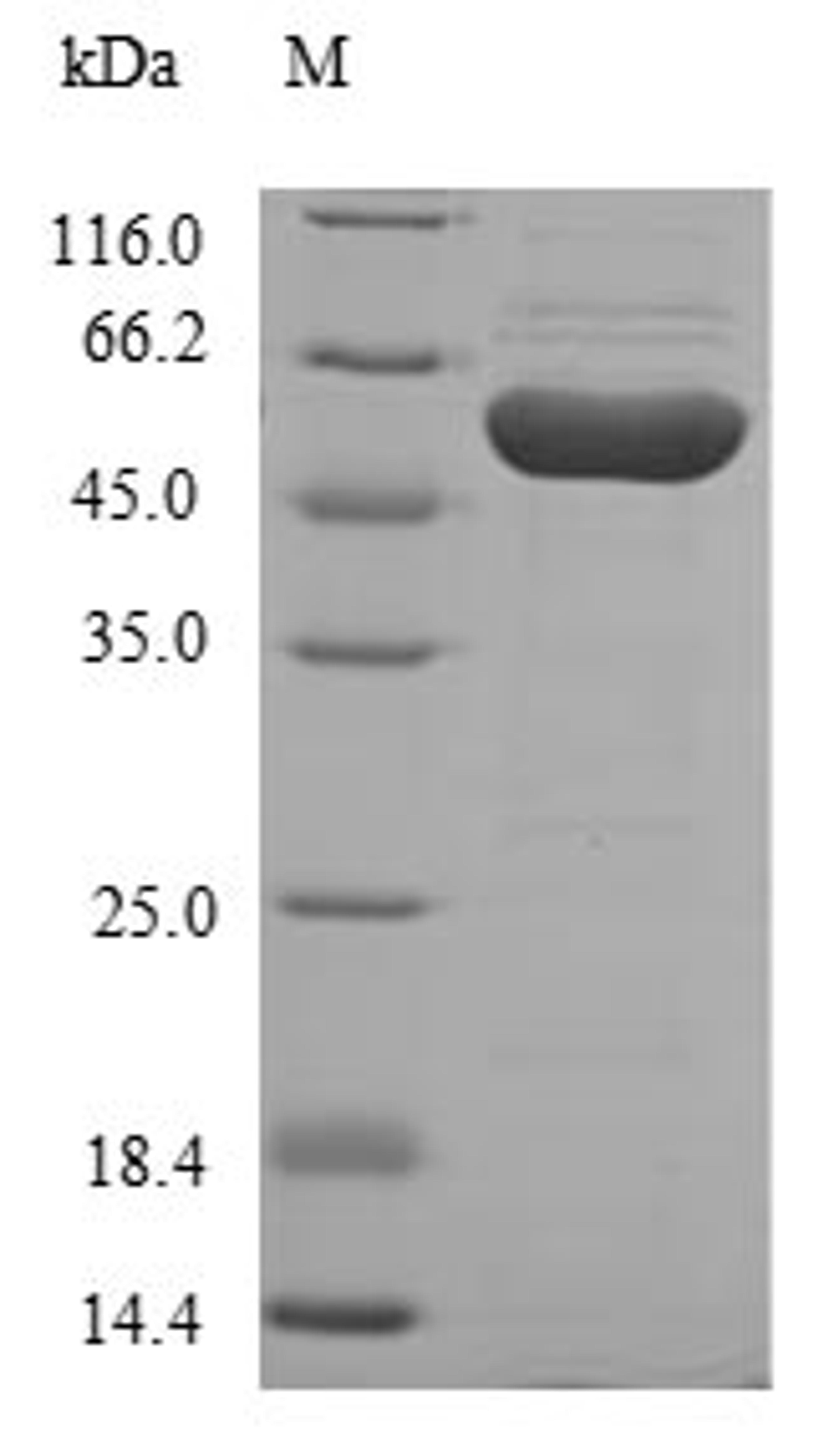 (Tris-Glycine gel) Discontinuous SDS-PAGE (reduced) with 5% enrichment gel and 15% separation gel.