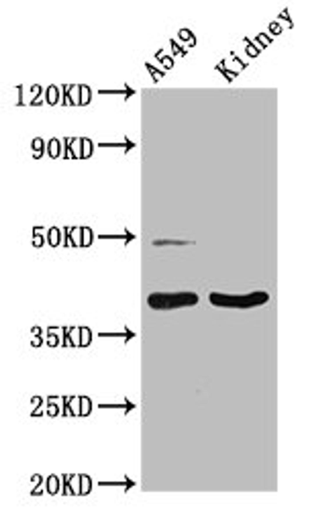 Western Blot. Positive WB detected in: A549 whole cell lysate, Rat kidney tissue. All lanes: LGALS12 antibody at 3µg/ml. Secondary. Goat polyclonal to rabbit IgG at 1/50000 dilution. Predicted band size: 38, 32, 37, 30, 36 kDa. Observed band size: 38 kDa
