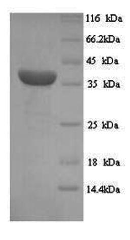 (Tris-Glycine gel) Discontinuous SDS-PAGE (reduced) with 5% enrichment gel and 15% separation gel.
