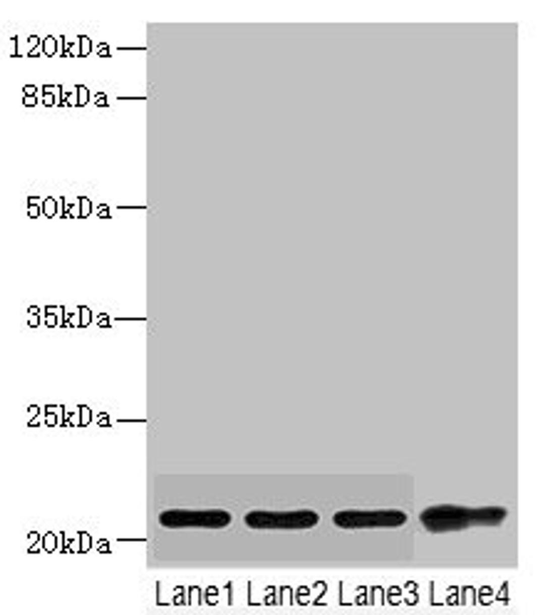 Western blot. All lanes: CSRP2 antibody at 5.74ug/ml. Lane 1: Mouse lung tissue. Lane 2: A375 whole cell lysate. Lane 3: A549 whole cell lysate. Lane 4: HepG2 whole cell lysate. Secondary. Goat polyclonal to rabbit IgG at 1/10000 dilution. Predicted band size: 21 kDa. Observed band size: 21 kDa. 