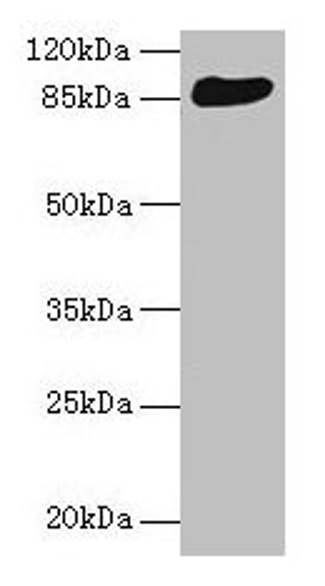 Western blot. All lanes: THAP12 antibody at 10µg/ml + HepG2 whole cell lysate. Secondary. Goat polyclonal to rabbit IgG at 1/10000 dilution. Predicted band size: 88, 57 kDa. Observed band size: 88 kDa