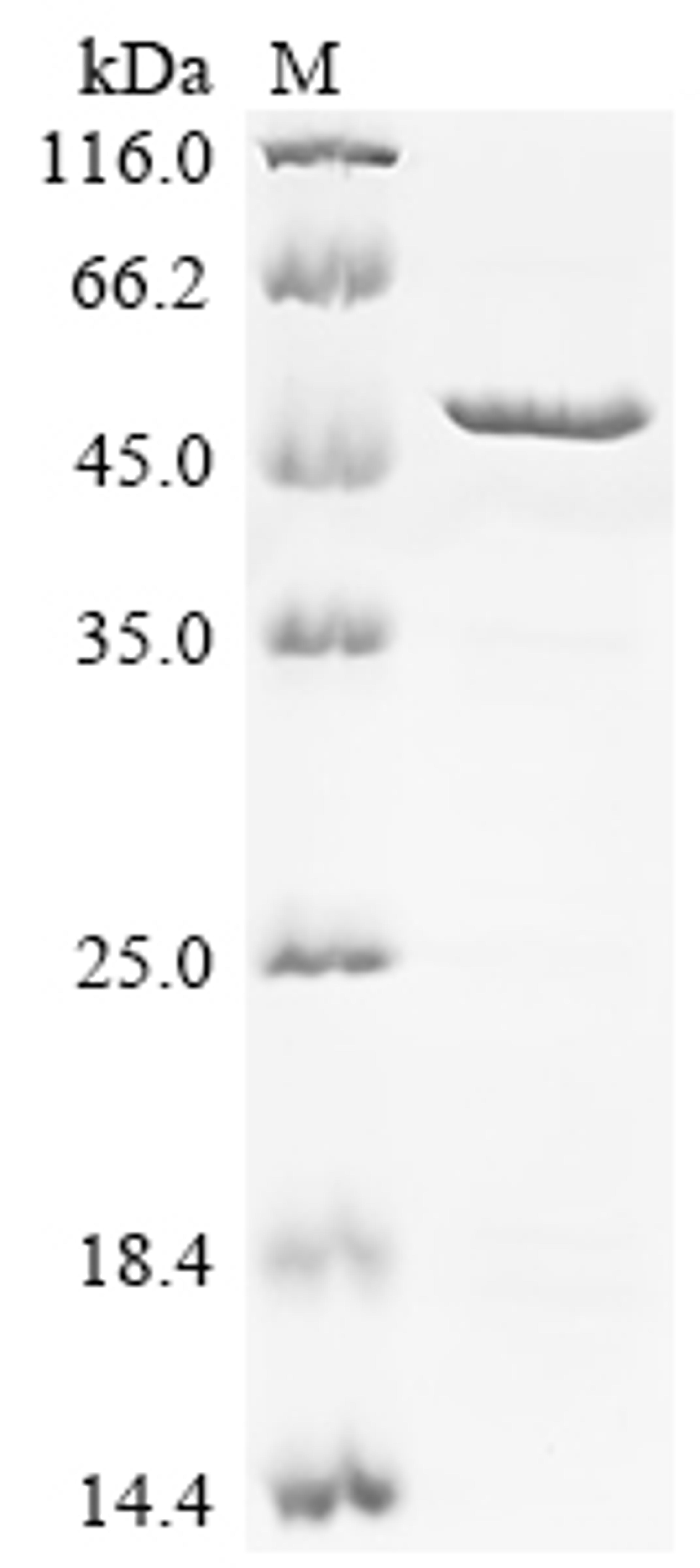 (Tris-Glycine gel) Discontinuous SDS-PAGE (reduced) with 5% enrichment gel and 15% separation gel.