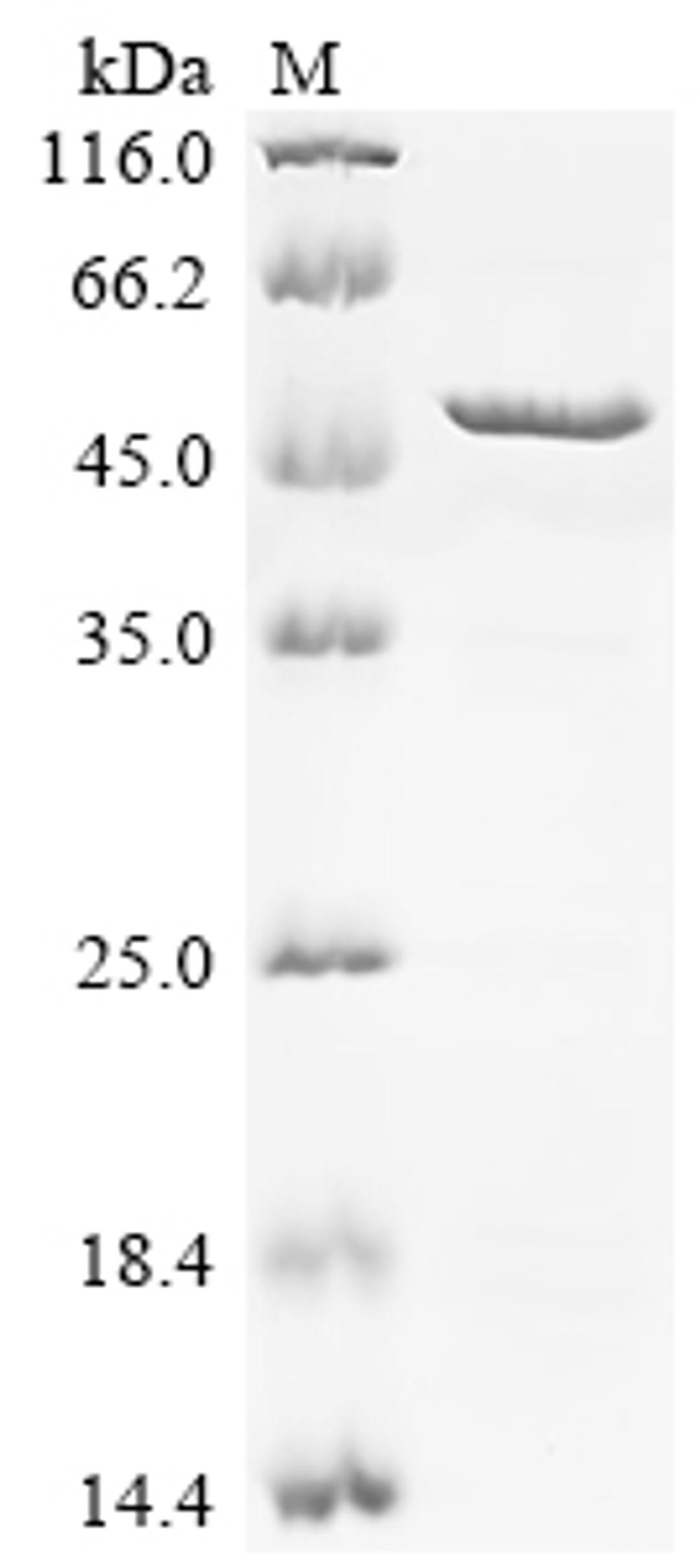 (Tris-Glycine gel) Discontinuous SDS-PAGE (reduced) with 5% enrichment gel and 15% separation gel.