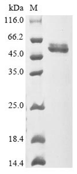 (Tris-Glycine gel) Discontinuous SDS-PAGE (reduced) with 5% enrichment gel and 15% separation gel.