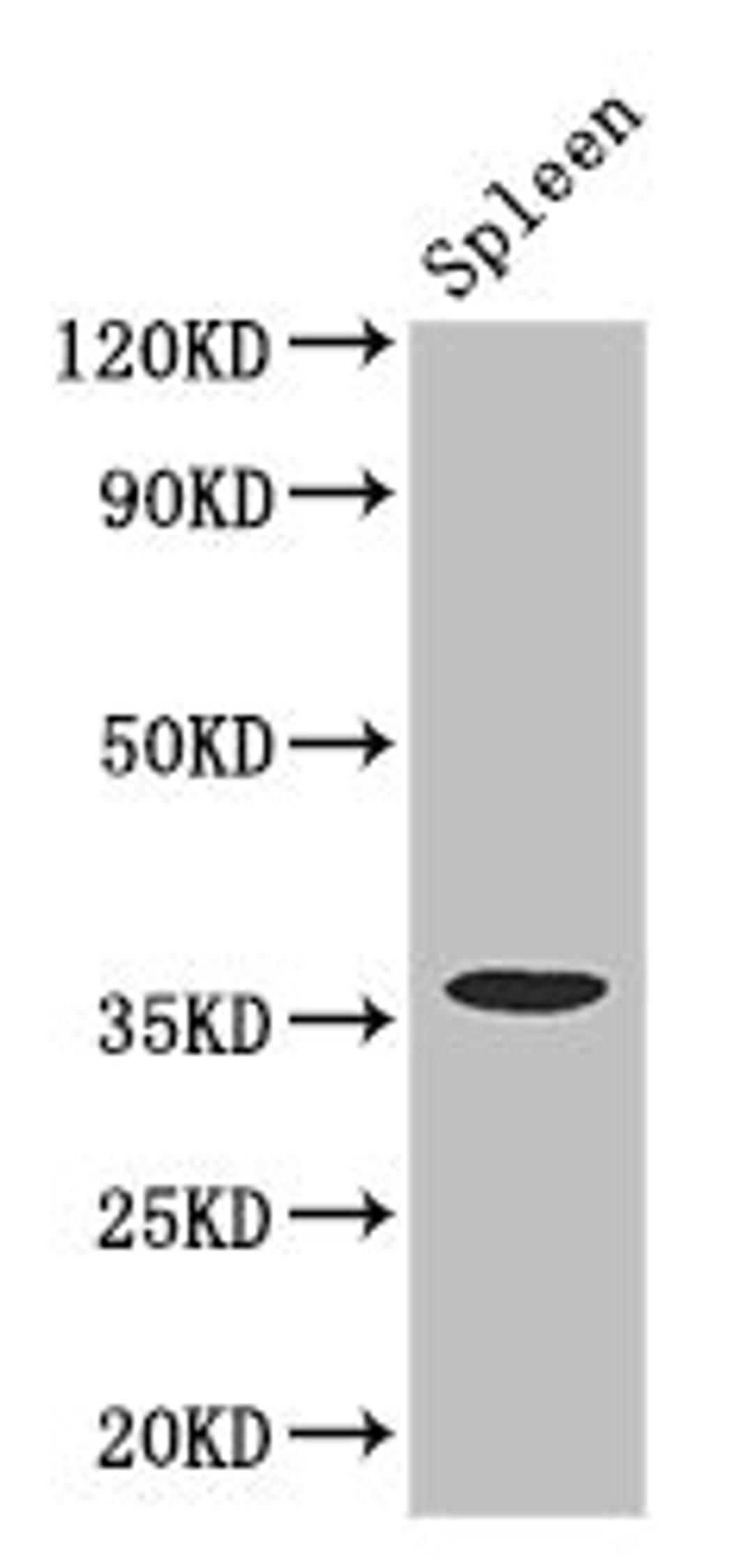 Western Blot. Positive WB detected in: Mouse spleen tissue. All lanes: FCGR2A antibody at 3.4ug/ml. Secondary. Goat polyclonal to rabbit IgG at 1/50000 dilution. Predicted band size: 36, 35 kDa. Observed band size: 36 kDa. 
