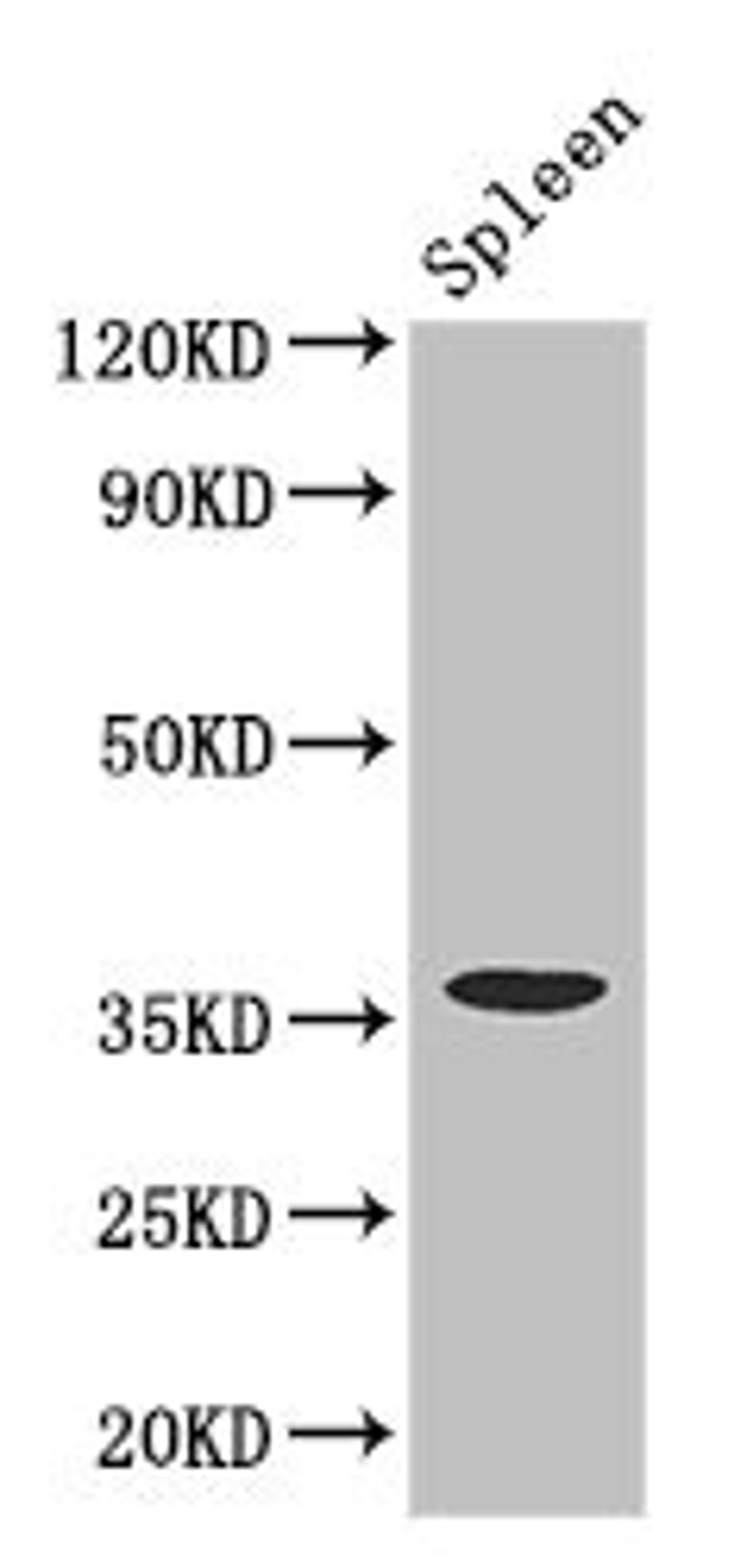 Western Blot. Positive WB detected in: Mouse spleen tissue. All lanes: FCGR2A antibody at 3.4ug/ml. Secondary. Goat polyclonal to rabbit IgG at 1/50000 dilution. Predicted band size: 36, 35 kDa. Observed band size: 36 kDa. 