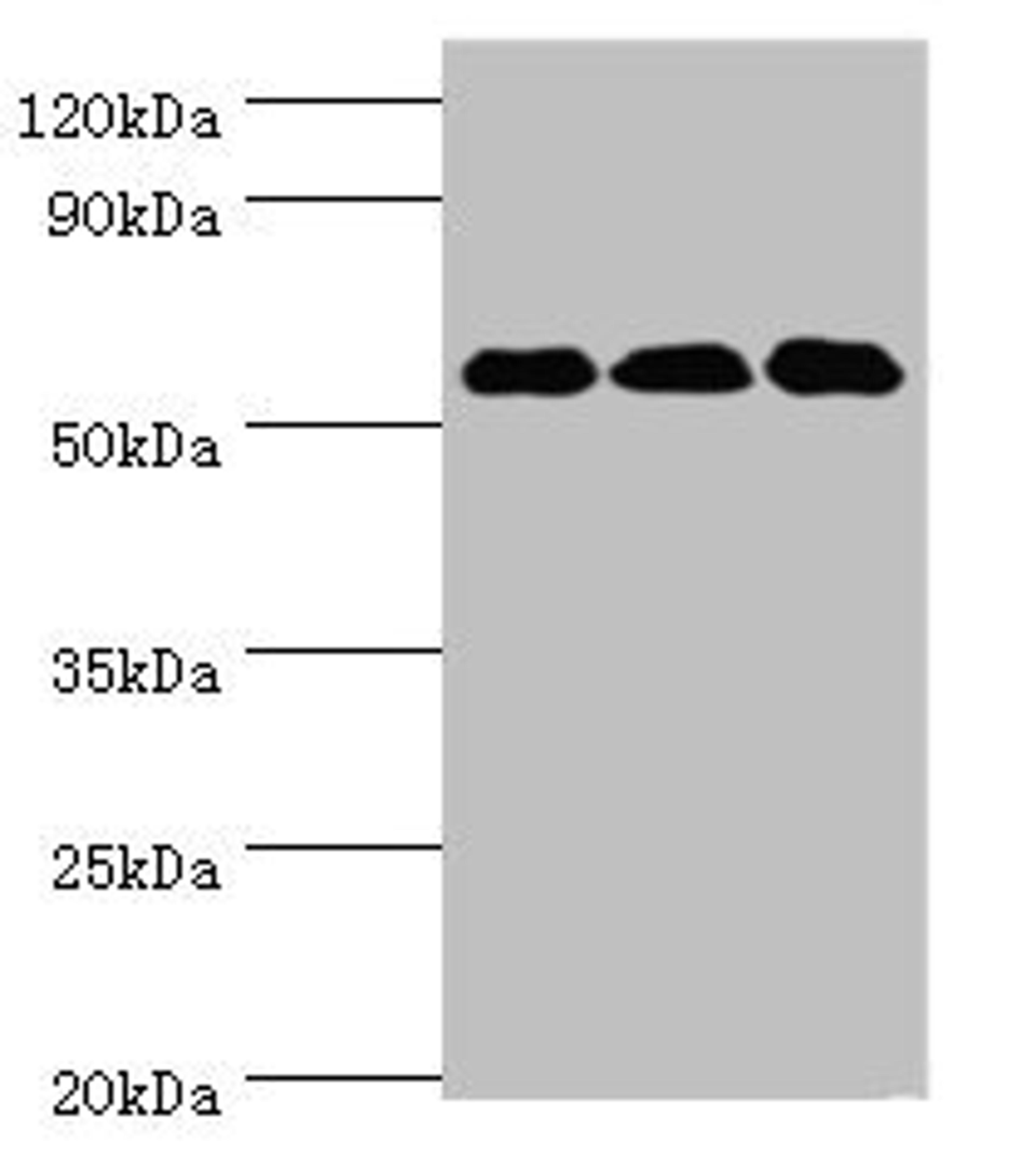 Western blot. All lanes: XIAP antibody at 3µg/ml. Lane 1: HepG2 whole cell lysate. Lane 2: MCF-7 whole cell lysate. Lane 3: PC-3 whole cell lysate. Secondary. Goat polyclonal to rabbit IgG&nbsp;at 1/10000 dilution. Predicted band size: 57 kDa. Observed band size: 57 kDa