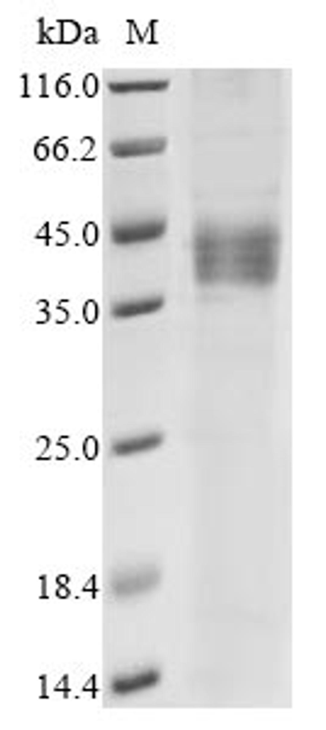 (Tris-Glycine gel) Discontinuous SDS-PAGE (reduced) with 5% enrichment gel and 15% separation gel.
