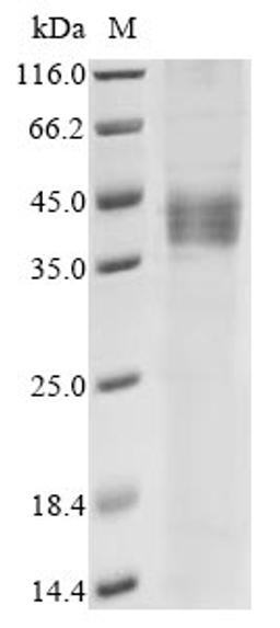 (Tris-Glycine gel) Discontinuous SDS-PAGE (reduced) with 5% enrichment gel and 15% separation gel.