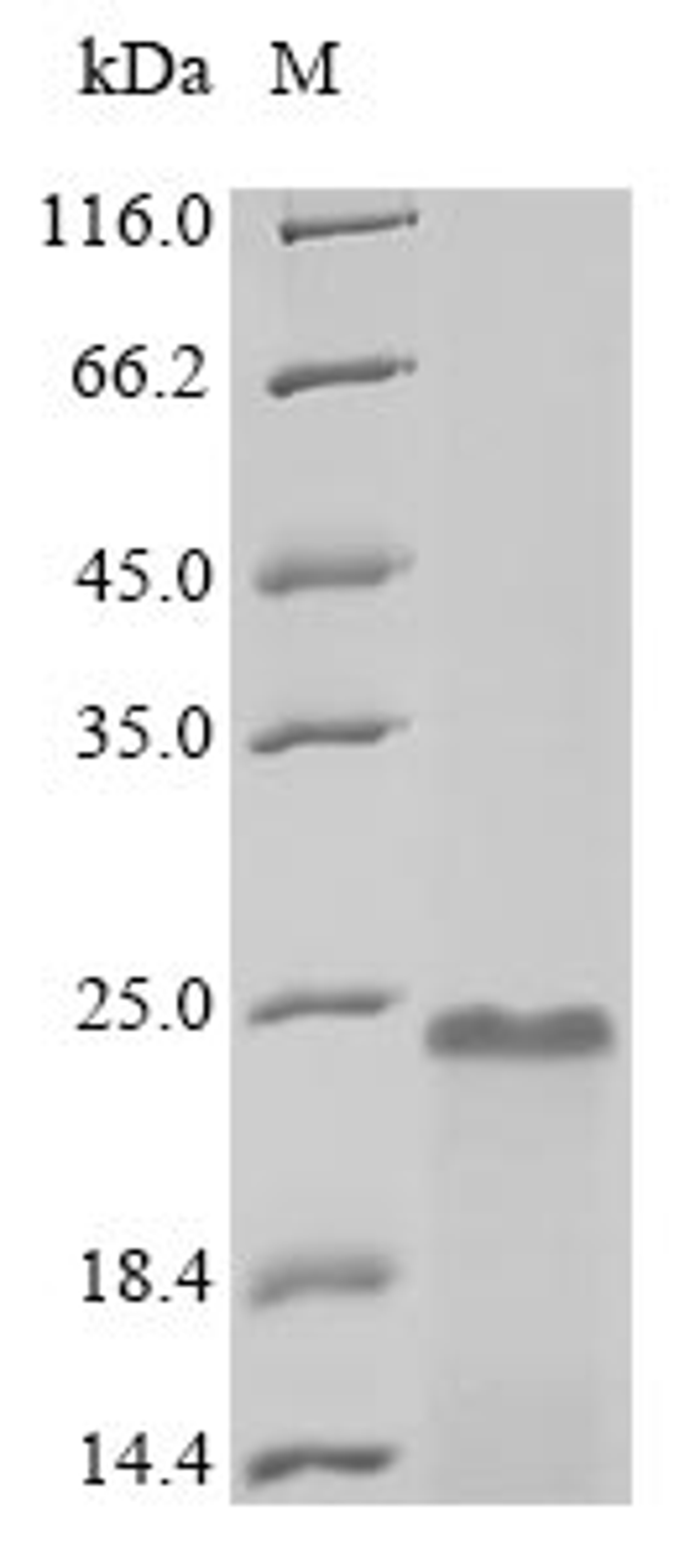(Tris-Glycine gel) Discontinuous SDS-PAGE (reduced) with 5% enrichment gel and 15% separation gel.