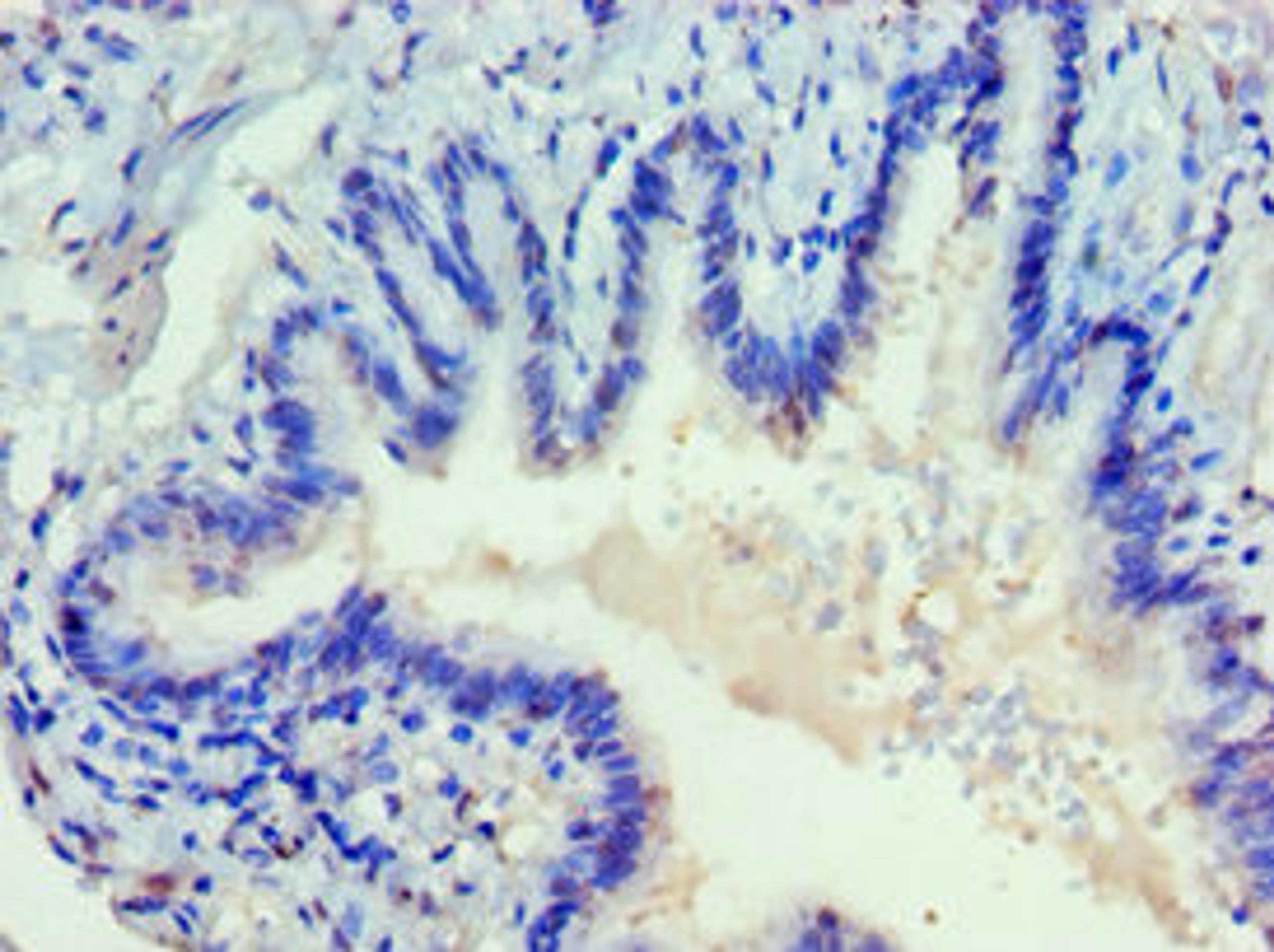 Immunohistochemistry of paraffin-embedded human lung tissue using CSB-PA007286ESR1HU at dilution of 1:100