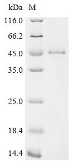 (Tris-Glycine gel) Discontinuous SDS-PAGE (reduced) with 5% enrichment gel and 15% separation gel.