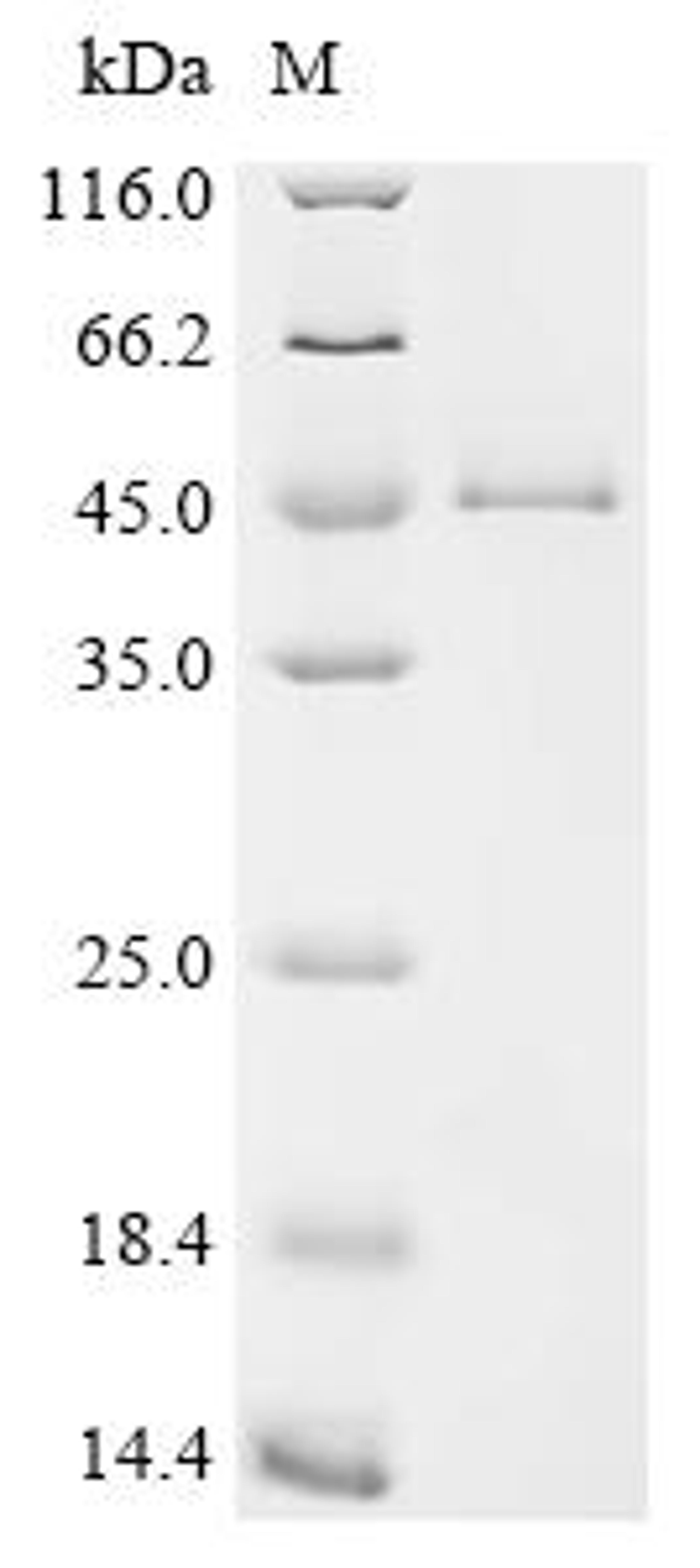 (Tris-Glycine gel) Discontinuous SDS-PAGE (reduced) with 5% enrichment gel and 15% separation gel.