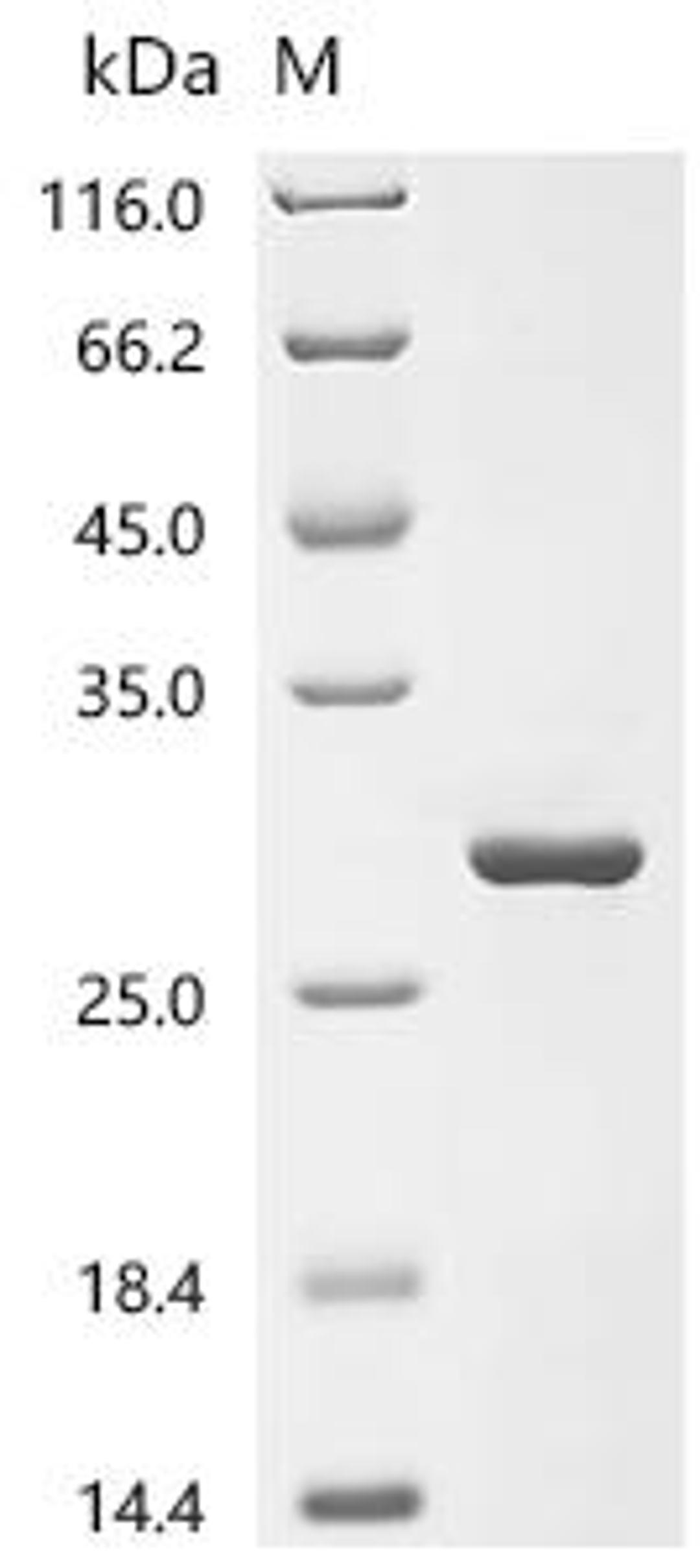 (Tris-Glycine gel) Discontinuous SDS-PAGE (reduced) with 5% enrichment gel and 15% separation gel.