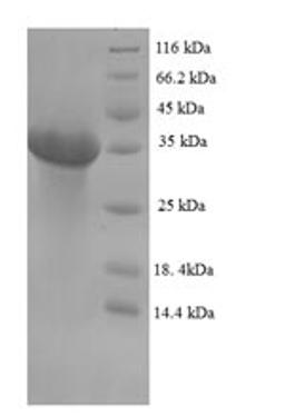 (Tris-Glycine gel) Discontinuous SDS-PAGE (reduced) with 5% enrichment gel and 15% separation gel.