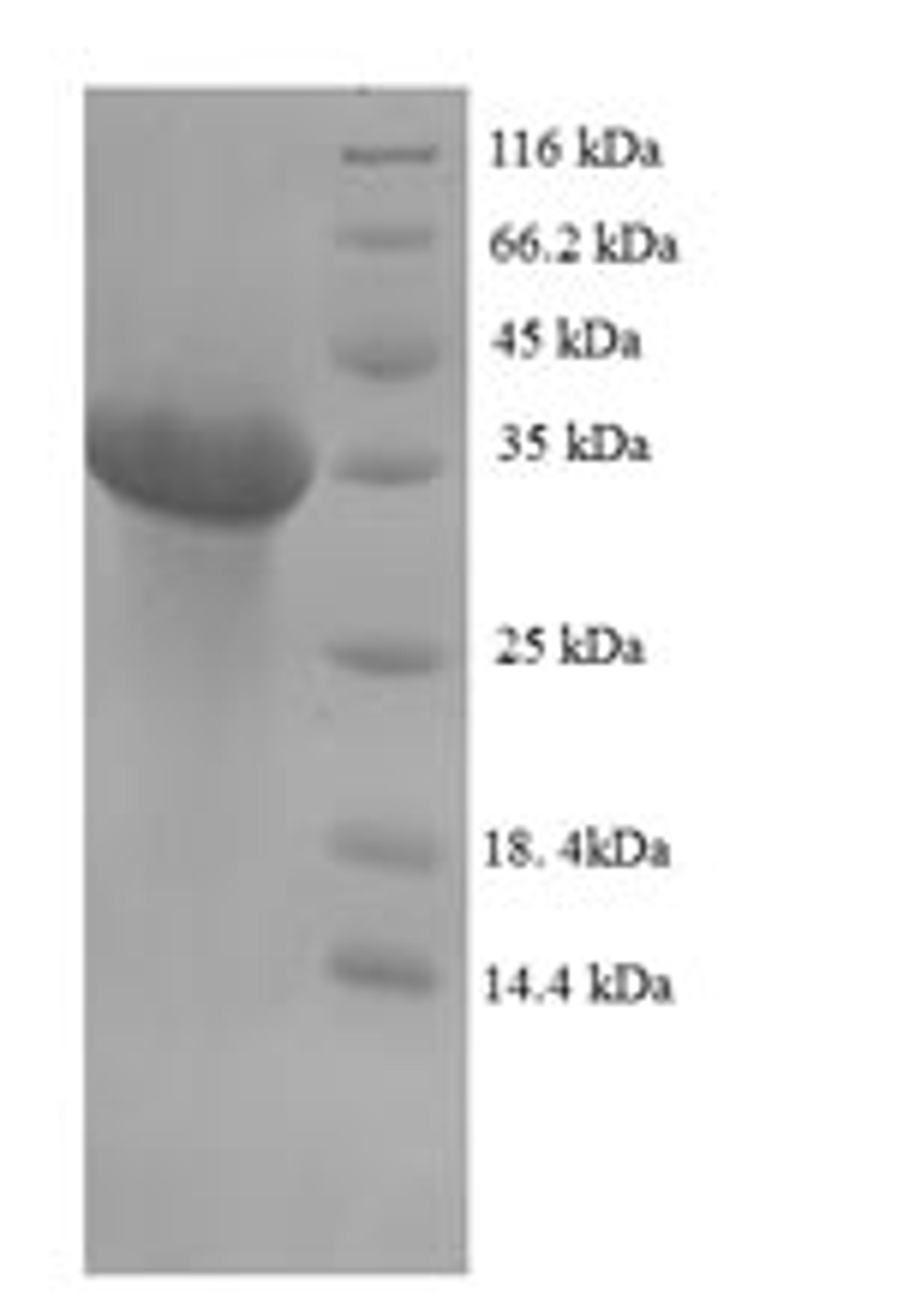 (Tris-Glycine gel) Discontinuous SDS-PAGE (reduced) with 5% enrichment gel and 15% separation gel.