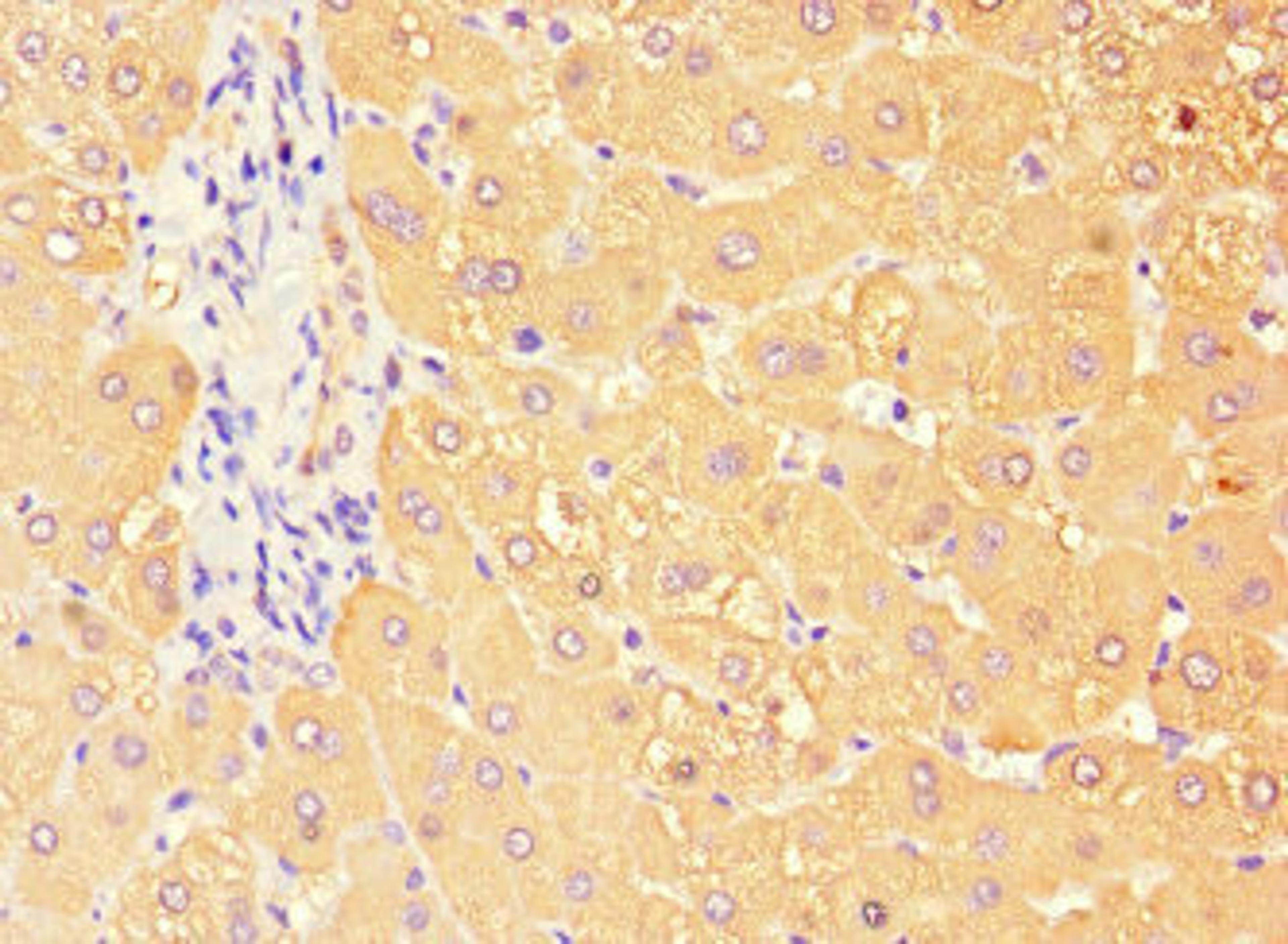 Immunohistochemistry of paraffin-embedded human liver tissue using CSB-PA873720LA01HU at dilution of 1:100