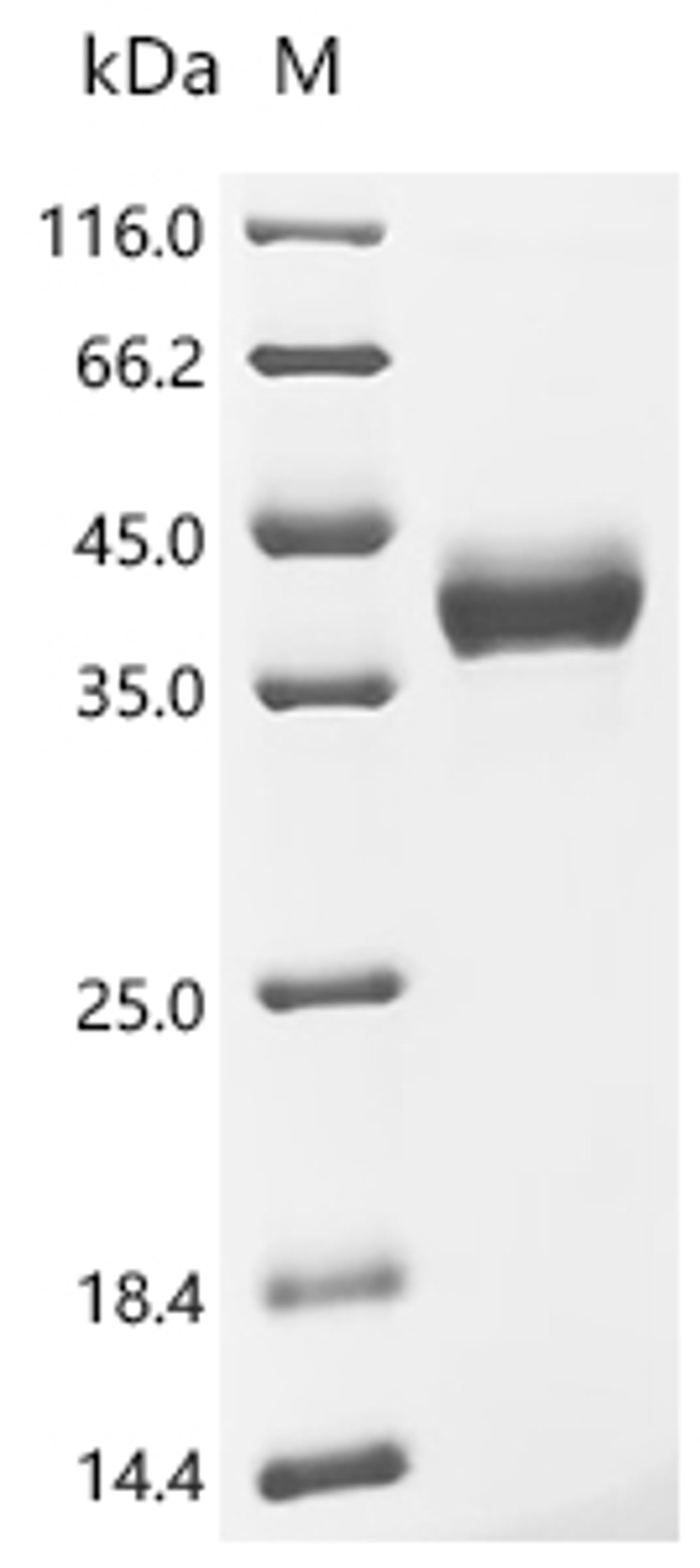 (Tris-Glycine gel) Discontinuous SDS-PAGE (reduced) with 5% enrichment gel and 15% separation gel.