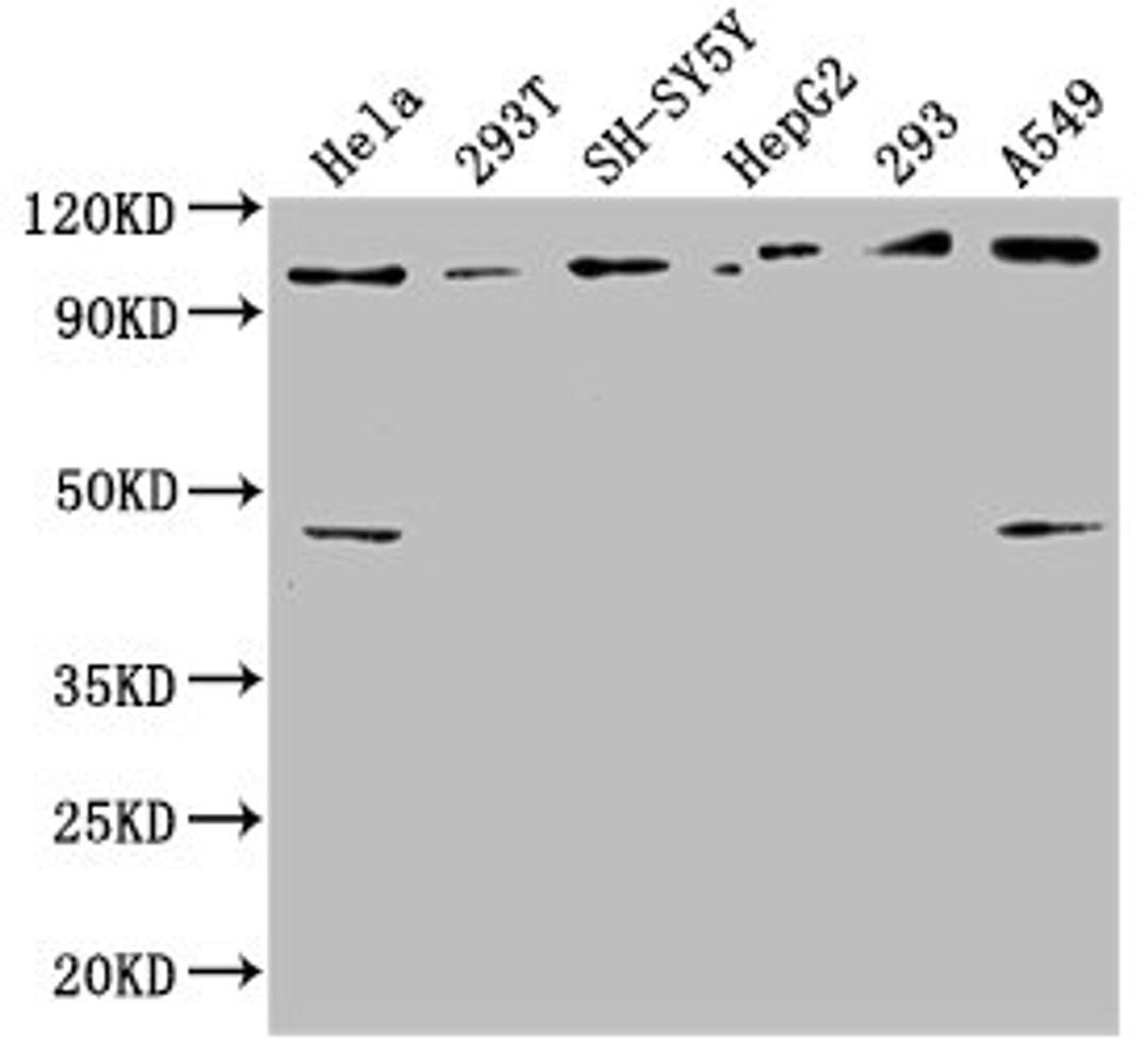 Western Blot. Positive WB detected in: Hela whole cell lysate, 293T whole cell lysate, SH-SY5Y whole cell lysate, HepG2 whole cell lysate, 293 whole cell lysate, A549 whole cell lysate. All lanes: RABEP1 antibody at 1:2500. Secondary. Goat polyclonal to rabbit IgG at 1/50000 dilution. Predicted band size: 100, 96 kDa. Observed band size: 100 kDa
