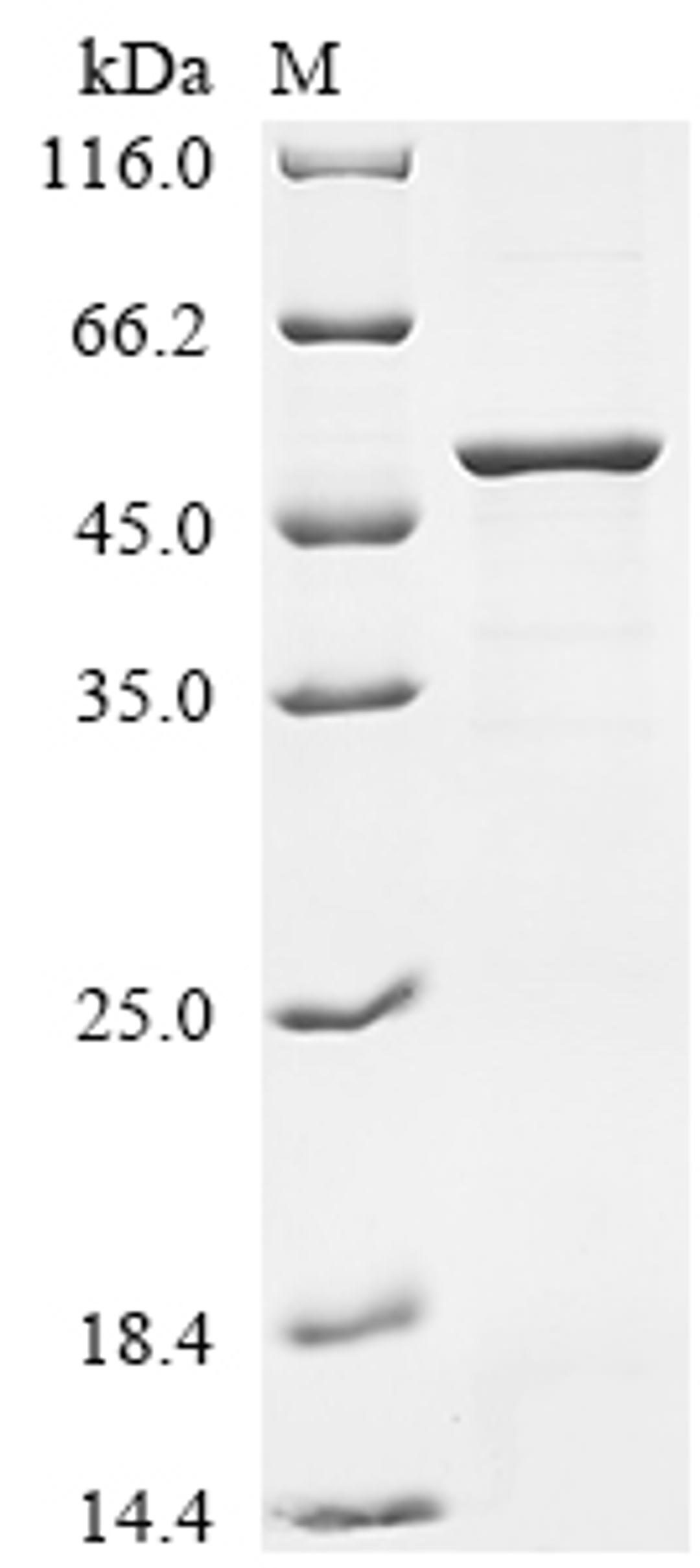 (Tris-Glycine gel) Discontinuous SDS-PAGE (reduced) with 5% enrichment gel and 15% separation gel.
