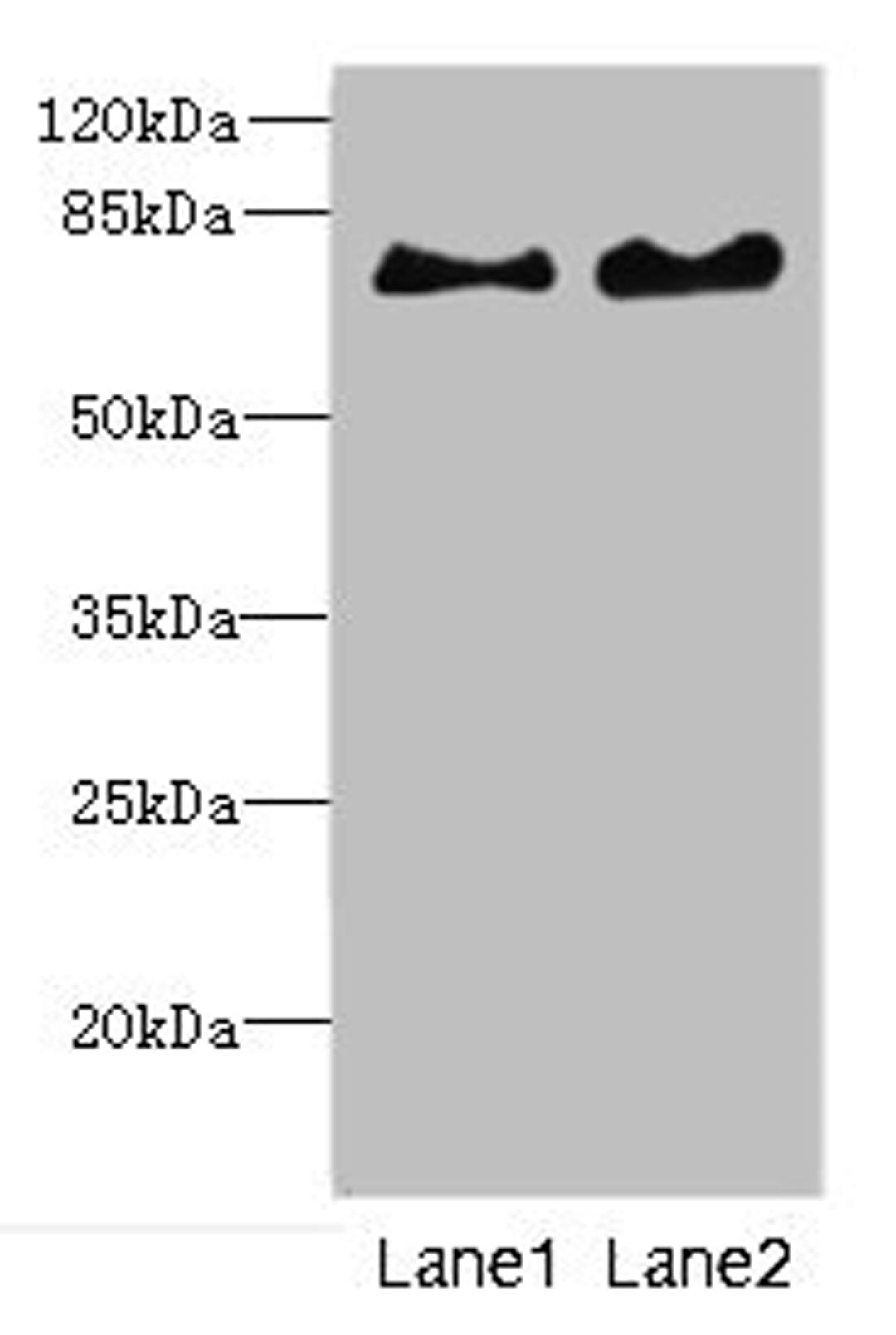 Western blot. All lanes: INTS10 antibody at 4.35ug/ml. Lane 1: Mouse kidney tissue. Lane 2: Rat gonadal tissue. Secondary. Goat polyclonal to rabbit IgG at 1/10000 dilution. Predicted band size: 82 kDa. Observed band size: 82 kDa. 