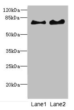 Western blot. All lanes: INTS10 antibody at 4.35ug/ml. Lane 1: Mouse kidney tissue. Lane 2: Rat gonadal tissue. Secondary. Goat polyclonal to rabbit IgG at 1/10000 dilution. Predicted band size: 82 kDa. Observed band size: 82 kDa. 