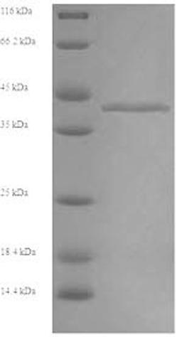 (Tris-Glycine gel) Discontinuous SDS-PAGE (reduced) with 5% enrichment gel and 15% separation gel.