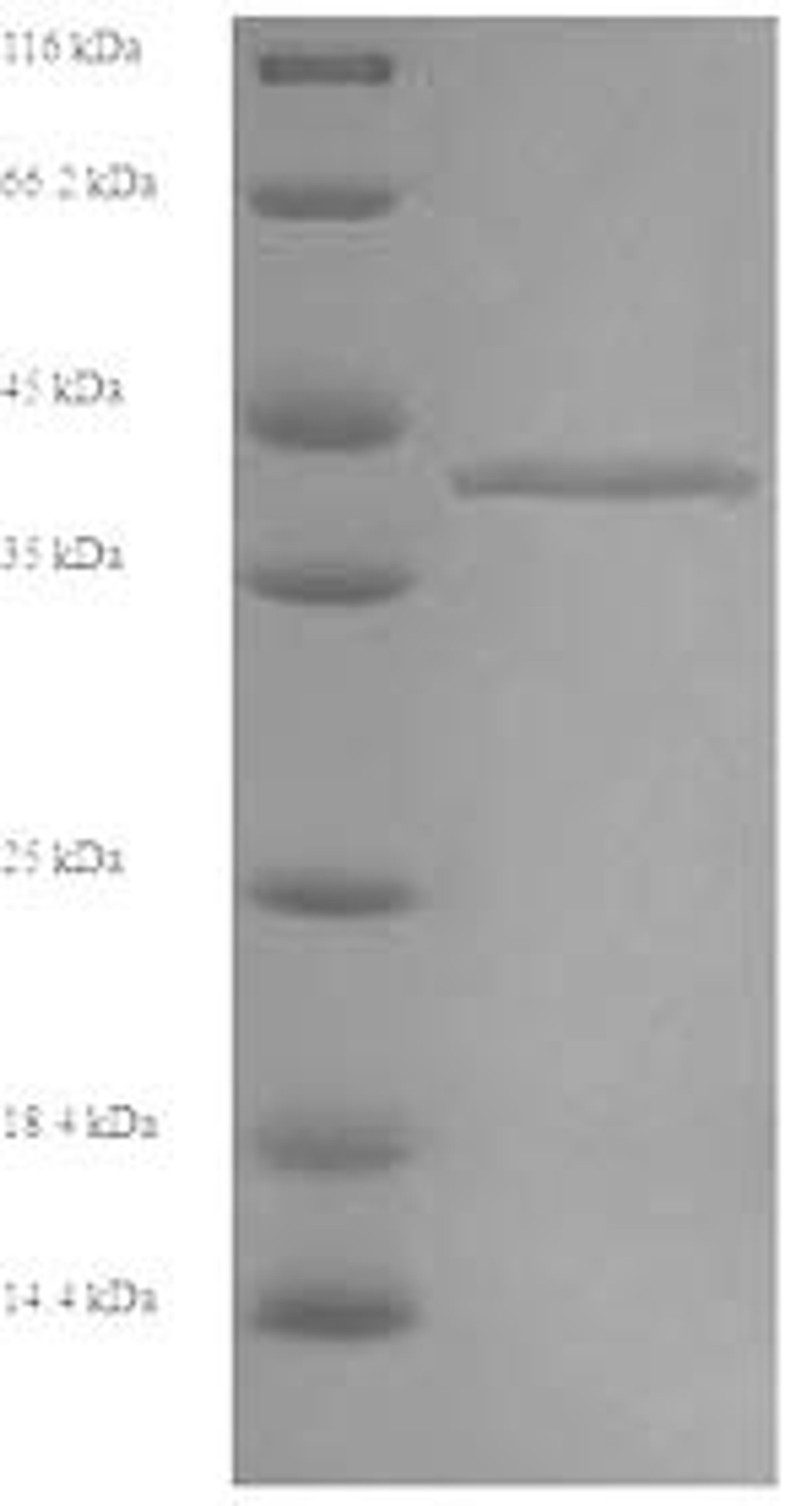 (Tris-Glycine gel) Discontinuous SDS-PAGE (reduced) with 5% enrichment gel and 15% separation gel.