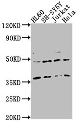 Western Blot. Positive WB detected in: HL60 whole cell lysate, SH-SY5Y whole cell lysate, Jurkat whole cell lysate, Hela whole cell lysate. All lanes: CASTOR2 antibody at 1:2000. Secondary. Goat polyclonal to rabbit IgG at 1/50000 dilution. Predicted band size: 37 kDa. Observed band size: 37 kDa. 