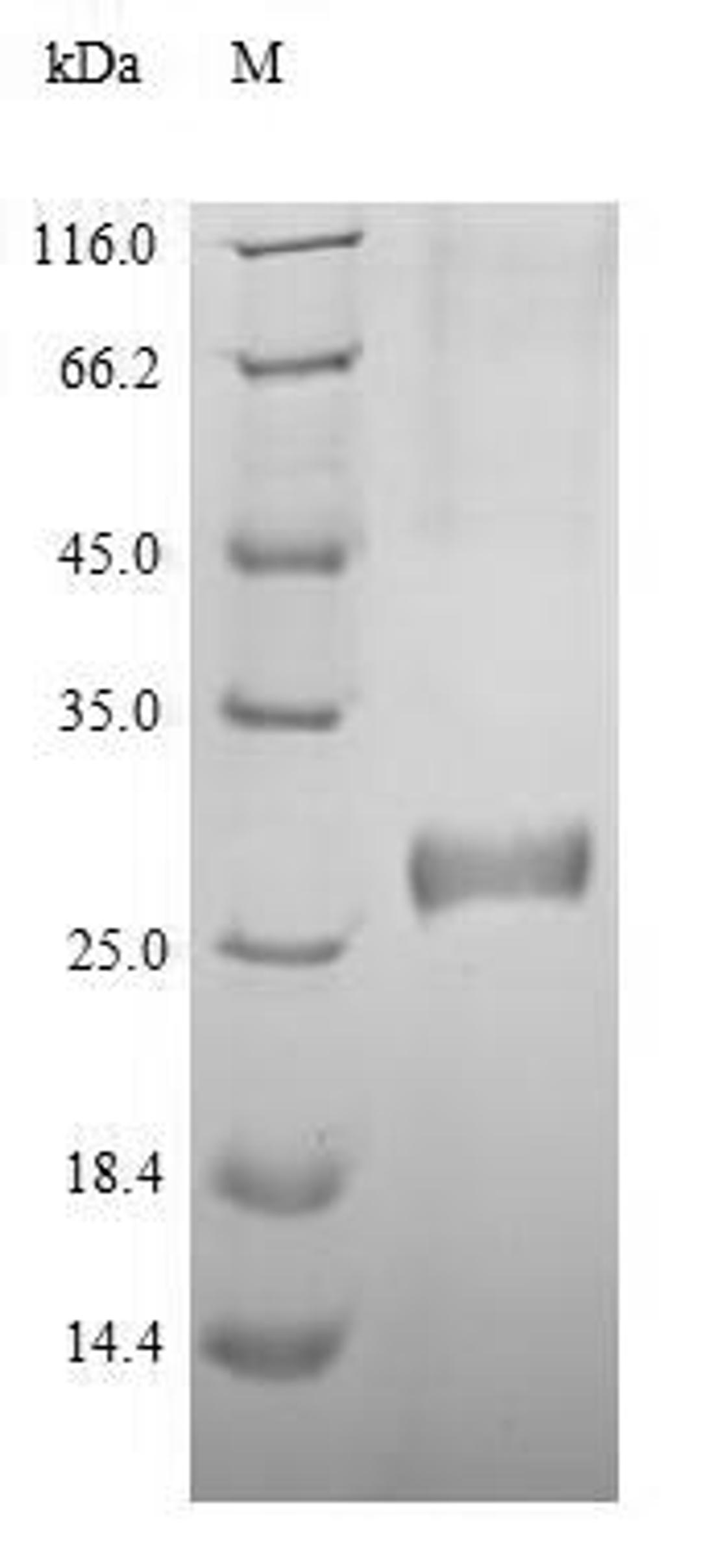 (Tris-Glycine gel) Discontinuous SDS-PAGE (reduced) with 5% enrichment gel and 15% separation gel.