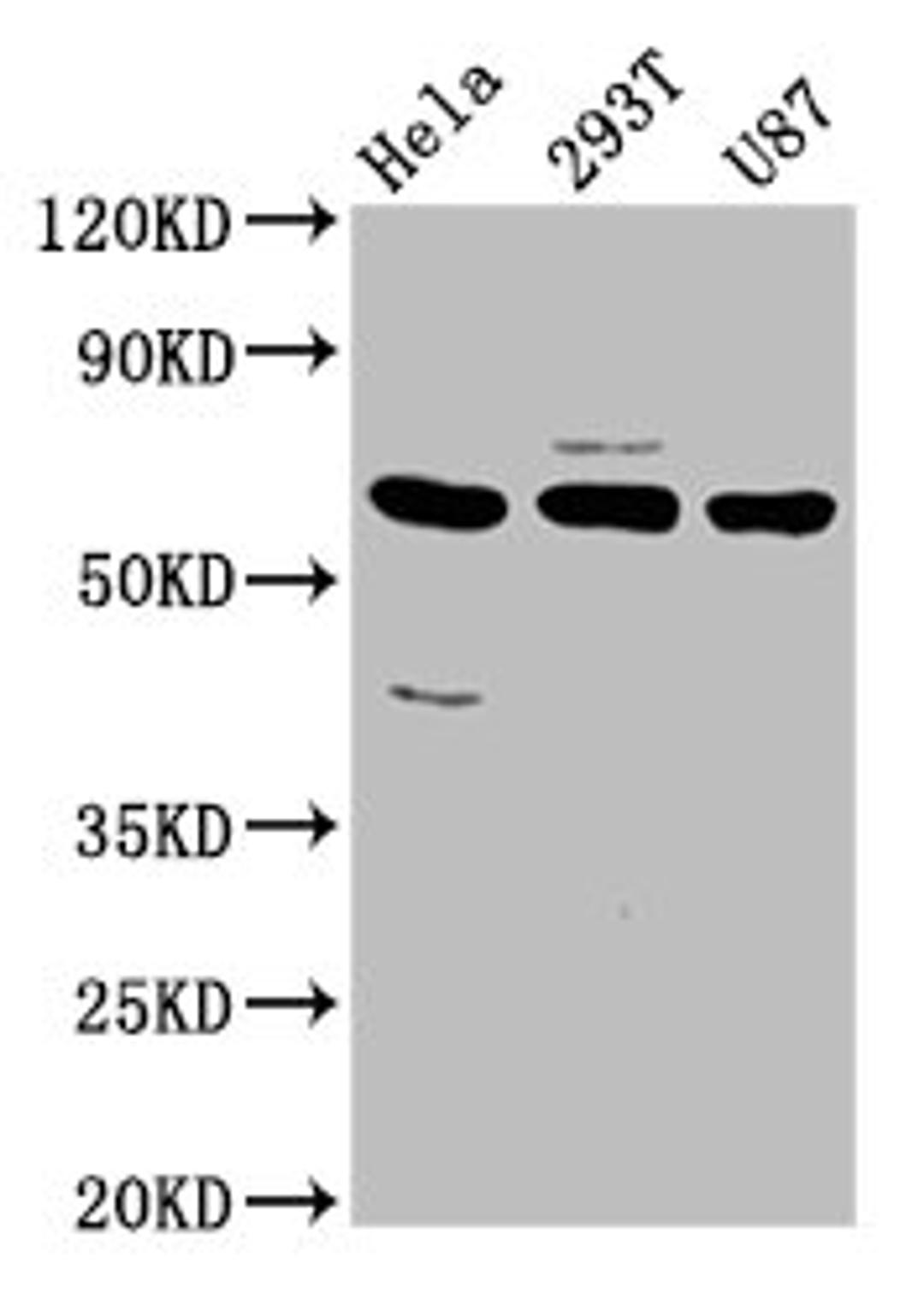Western Blot. Positive WB detected in: Hela whole cell lysate, 293T whole cell lysate, U87 whole cell lysate. All lanes: NETO1 antibody at 3.2ug/ml. Secondary. Goat polyclonal to rabbit IgG at 1/50000 dilution. Predicted band size: 61, 18 kDa. Observed band size: 61 kDa. 