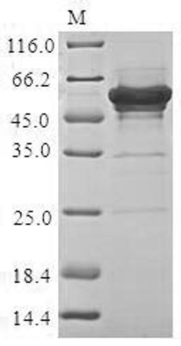 (Tris-Glycine gel) Discontinuous SDS-PAGE (reduced) with 5% enrichment gel and 15% separation gel.