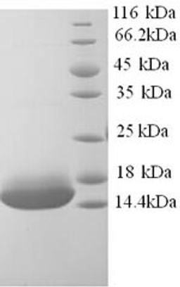 (Tris-Glycine gel) Discontinuous SDS-PAGE (reduced) with 5% enrichment gel and 15% separation gel.