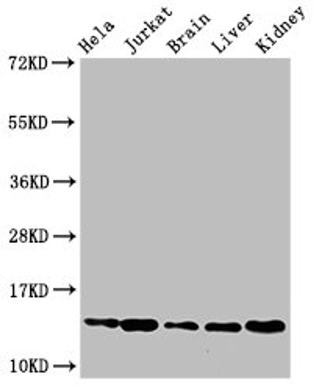 Western Blot. Positive WB detected in: Hela cell acid extracts, Jurkat cell acid extracts, Mouse brain tissue, Mouse liver tissue, Mouse kidney tissue. All lanes: HIST1H2BB antibody at 2.5µg/ml. Secondary. Goat polyclonal to rabbit IgG at 1/50000 dilution. Predicted band size: 14 kDa. Observed band size: 14 kDa
