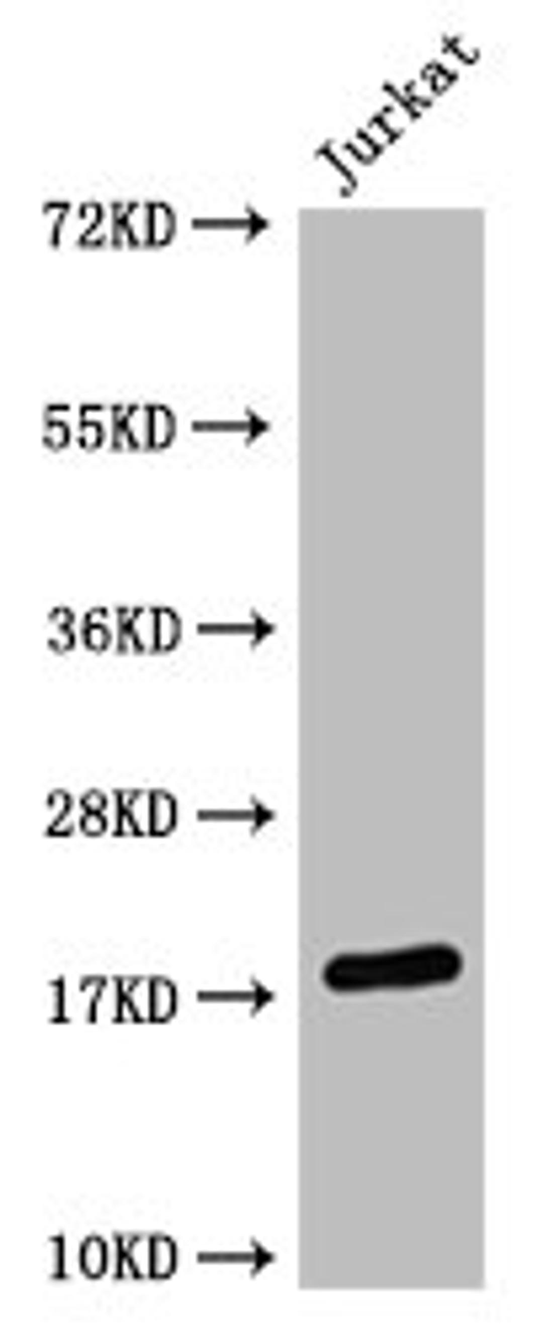 Western Blot. Positive WB detected in:  Jurkat whole cell lysate HistonC1 antibody at 1:1000. Secondary. Goat polyclonal to mouse IgG at 1/50000 dilution. Predicted band size: 15-25 KDa. Observed band size: 15-25 KDa. Exposure time：5min