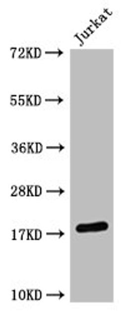 Western Blot. Positive WB detected in:  Jurkat whole cell lysate HistonC1 antibody at 1:1000. Secondary. Goat polyclonal to mouse IgG at 1/50000 dilution. Predicted band size: 15-25 KDa. Observed band size: 15-25 KDa. Exposure time：5min