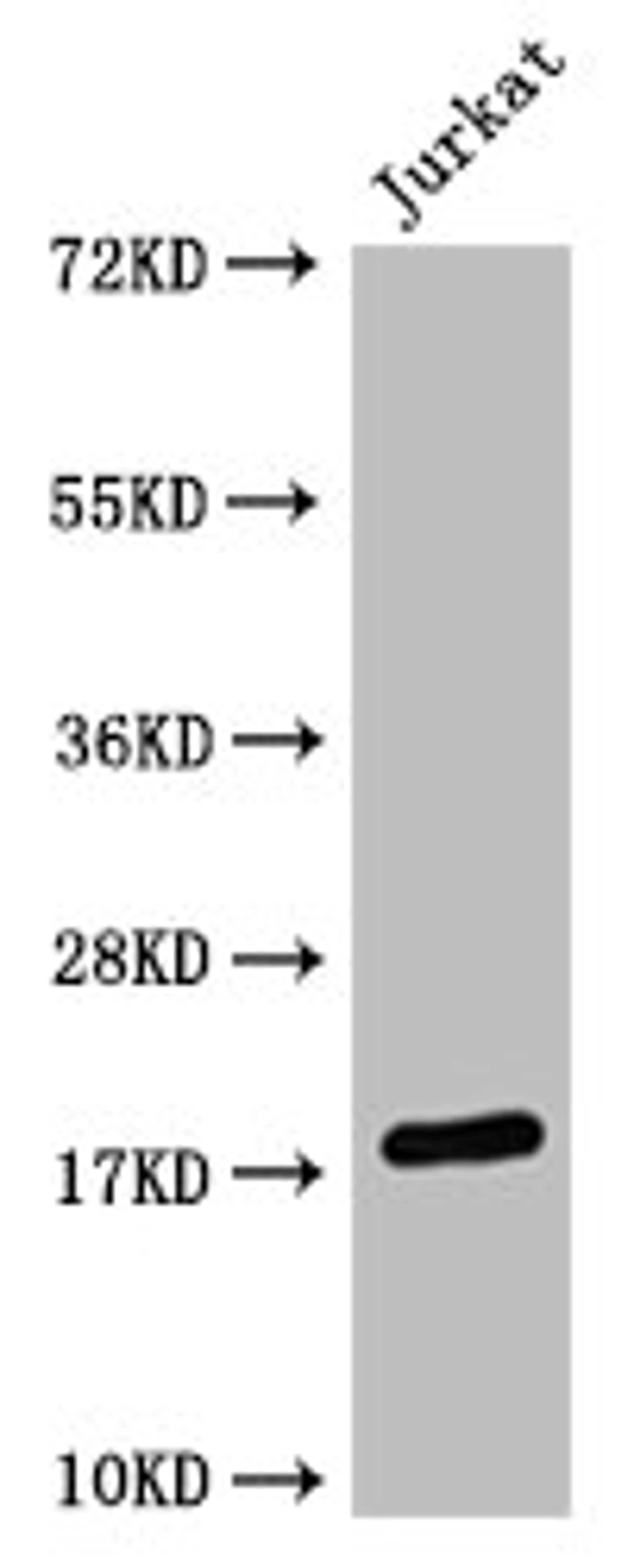 Western Blot. Positive WB detected in:  Jurkat whole cell lysate HistonC1 antibody at 1:1000. Secondary. Goat polyclonal to mouse IgG at 1/50000 dilution. Predicted band size: 15-25 KDa. Observed band size: 15-25 KDa. Exposure time：5min