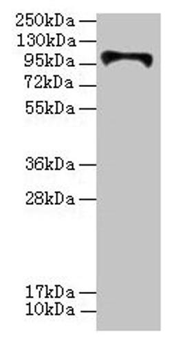Western blot. All lanes: HKDC1 antibody at 4µg/ml + U87 whole cell lysate. Secondary. Goat polyclonal to rabbit IgG at 1/10000 dilution. Predicted band size: 103, 91, 83 kDa. Observed band size: 103 kDa